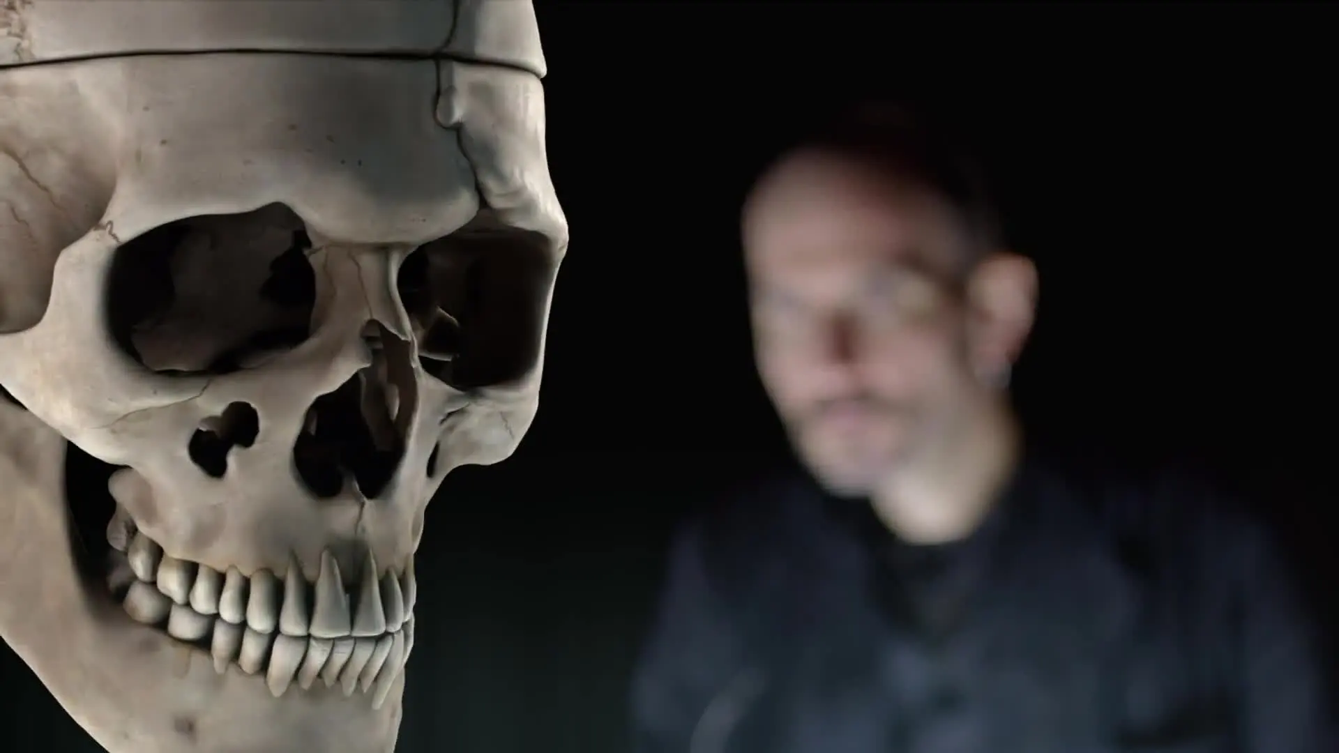 E2.Phineas Gage's Skull