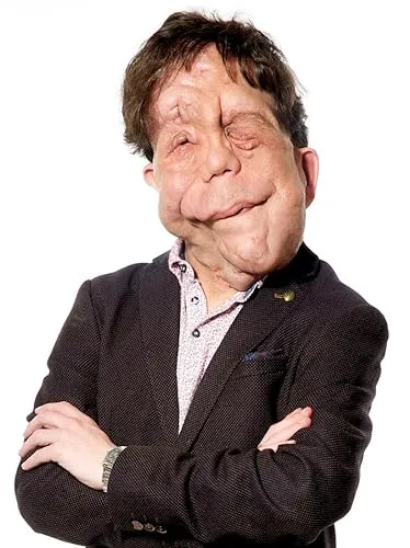 Adam Pearson