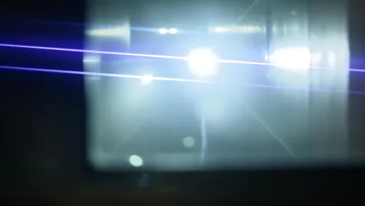 E10.Seizure