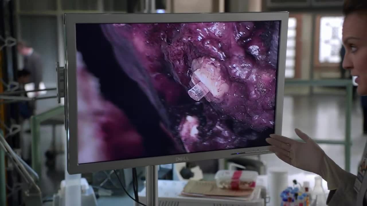 Bones Episódio 15